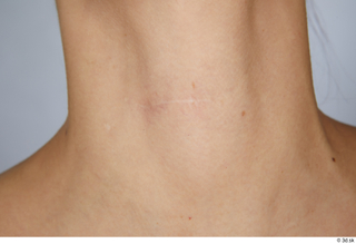 Cynthia nude scar skin 0002.jpg
